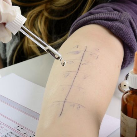 Allergie: was hilft gegen Heuschnupfen & Hausstaubmilben