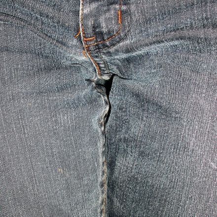 Inkontinenz: Nicht mehr ganz dicht?