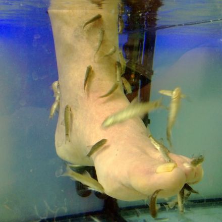 Dornwarzen am Fuß auf natürlichem Weg entfernen