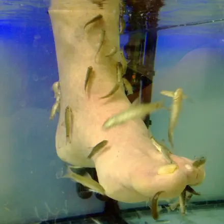 Dornwarzen am Fuß auf natürlichem Weg entfernen