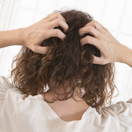 Glühend heiße und juckende Kopfhaut endlich besiegt