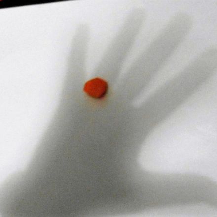 Was tun bei Leichtgläubigkeit oder Altersstarrsinn?