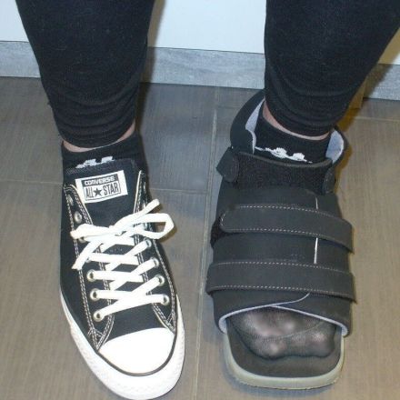 Hallux valgus: Besser laufen durch Vortäuschung falscher Tatsachen