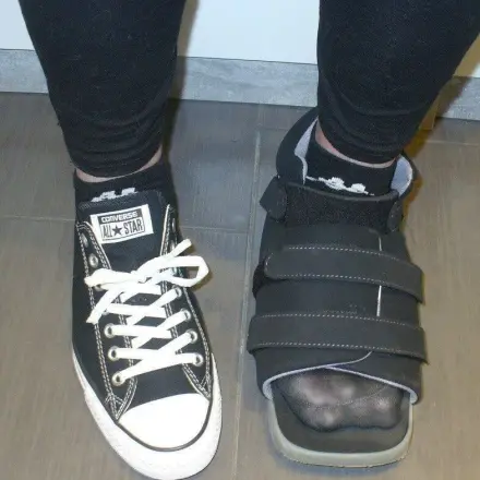 Hallux valgus: Besser laufen durch Vortäuschung falscher Tatsachen