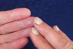 Melkfett statt teurer Cremes