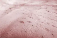 Stockflecken entfernen mit Essig