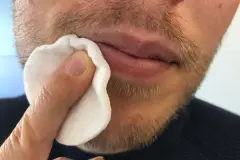 Herpes bek&auml;mpfen - extrem aber wirksam