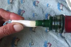 Soforthilfe bei Scheidenpilz