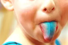 Blaue Zunge nach dem Essen von Waldheidelbeeren?