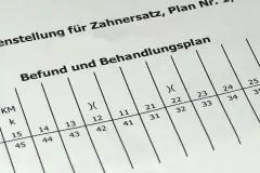 Kostenvoranschlag vom Zahnarzt - Alternativvorschlag einholen