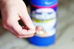 Wei&szlig;e Z&auml;hne (Gebiss)