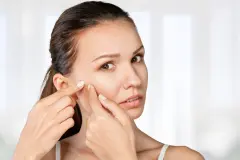 Gut gegen Pickel: Aspirin