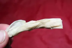 Verstopfte Nase - schnelle Hilfe