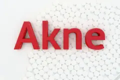 Schwere Akne loswerden - langfristig