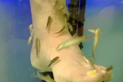 Dornwarzen am Fu&szlig; auf nat&uuml;rlichem Weg entfernen