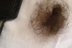 Haarausfall bedingt durch Stillen