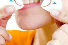 Herpes stoppen &ndash; SOS-Tipp
