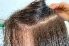 Von schwarz gef&auml;rbten Haaren zur&uuml;ck zur hellen Naturhaarfarbe