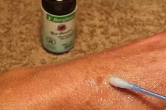 Warzen entfernen mit Teebaum&ouml;l